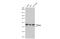 NIMA Related Kinase 2 antibody, GTX70281, GeneTex, Western Blot image 