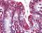 Mycobacterium tuberculosis groEL antibody, orb87925, Biorbyt, Immunohistochemistry paraffin image 