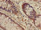 WASP Family Member 1 antibody, LS-C680014, Lifespan Biosciences, Immunohistochemistry paraffin image 