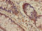 SCAR1 antibody, LS-C680014, Lifespan Biosciences, Immunohistochemistry paraffin image 