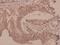 Diacylglycerol Kinase Theta antibody, A08705S725, Boster Biological Technology, Immunohistochemistry paraffin image 