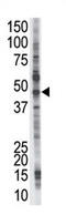 Proteasome 26S Subunit, Non-ATPase 4 antibody, AP11951PU-N, Origene, Western Blot image 