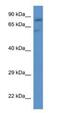 Solute Carrier Family 26 Member 2 antibody, NBP1-80522, Novus Biologicals, Western Blot image 