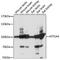 ATPase Na+/K+ Transporting Subunit Alpha 4 antibody, A15256, ABclonal Technology, Western Blot image 