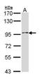 Type II inositol-1,4,5-trisphosphate 5-phosphatase antibody, GTX112444, GeneTex, Western Blot image 