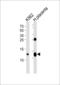 Hemoglobin Subunit Gamma 2 antibody, 61-057, ProSci, Western Blot image 