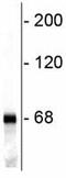 Neurofilament Light antibody, ab72997, Abcam, Western Blot image 