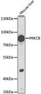 Protein Kinase C Beta antibody, 15-109, ProSci, Western Blot image 