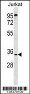 UBX Domain Protein 8 antibody, 58-688, ProSci, Western Blot image 