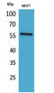 Activin A Receptor Like Type 1 antibody, STJ96547, St John