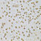 Integrin Linked Kinase antibody, 13-317, ProSci, Immunohistochemistry frozen image 
