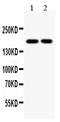 DNA Topoisomerase II Alpha antibody, PA1127, Boster Biological Technology, Western Blot image 