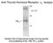 Thyroid Hormone Receptor Alpha antibody, NB100-61087, Novus Biologicals, Western Blot image 