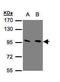 Glutamate Metabotropic Receptor 3 antibody, GTX108212, GeneTex, Western Blot image 