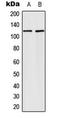 Fibroblast Growth Factor Receptor 1 antibody, LS-C354005, Lifespan Biosciences, Western Blot image 