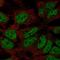 Zinc Finger Protein 560 antibody, HPA045439, Atlas Antibodies, Immunocytochemistry image 