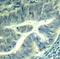 Cyclin Dependent Kinase 6 antibody, LS-C335940, Lifespan Biosciences, Immunohistochemistry paraffin image 