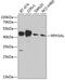 Rab effector Noc2 antibody, GTX32846, GeneTex, Western Blot image 