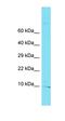 Tubulin Epsilon And Delta Complex 2 antibody, orb326814, Biorbyt, Western Blot image 