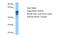 Probable protein-cysteine N-palmitoyltransferase porcupine antibody, ARP49762_P050, Aviva Systems Biology, Western Blot image 