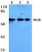 Hexosaminidase Subunit Beta antibody, A02290S516, Boster Biological Technology, Western Blot image 