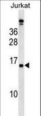 Placenta-specific protein 4 antibody, LS-C163766, Lifespan Biosciences, Western Blot image 