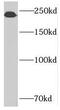 SPT6 Homolog, Histone Chaperone And Transcription Elongation Factor antibody, FNab08395, FineTest, Western Blot image 