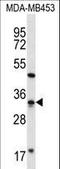 FtsJ RNA 2'-O-Methyltransferase 1 antibody, LS-C166271, Lifespan Biosciences, Western Blot image 