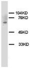 Serine/threonine-protein kinase Chk2 antibody, AP23321PU-N, Origene, Western Blot image 