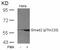 SMAD2 antibody, PA5-37635, Invitrogen Antibodies, Western Blot image 