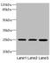 Transmembrane Protein 65 antibody, A63656-100, Epigentek, Western Blot image 