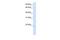 Chromosome 14 Open Reading Frame 180 antibody, GTX46688, GeneTex, Western Blot image 