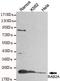 RAB2A, Member RAS Oncogene Family antibody, M06007, Boster Biological Technology, Western Blot image 