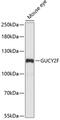 Retinal guanylyl cyclase 2 antibody, GTX66239, GeneTex, Western Blot image 