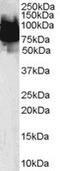 Kruppel Like Factor 4 antibody, MBS420312, MyBioSource, Western Blot image 