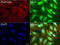 GLI Family Zinc Finger 1 antibody, LS-C796900, Lifespan Biosciences, Immunofluorescence image 