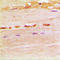 Uracil-DNA glycosylase antibody, LS-C352979, Lifespan Biosciences, Immunohistochemistry paraffin image 