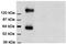 Solute Carrier Family 1 Member 3 antibody, ab416, Abcam, Western Blot image 