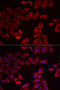 Selenophosphate Synthetase 1 antibody, LS-C748452, Lifespan Biosciences, Immunofluorescence image 