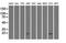 Crystallin Alpha B antibody, NBP1-47708, Novus Biologicals, Western Blot image 