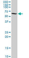 Protein Phosphatase 2 Regulatory Subunit B'Delta antibody, LS-C139225, Lifespan Biosciences, Western Blot image 