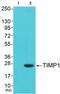 TIMP Metallopeptidase Inhibitor 1 antibody, abx013210, Abbexa, Western Blot image 