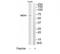 Menin 1 antibody, TA314187, Origene, Western Blot image 