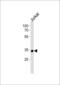 Small Nuclear RNA Activating Complex Polypeptide 2 antibody, PA5-35172, Invitrogen Antibodies, Western Blot image 