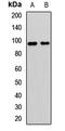 GLI Family Zinc Finger 2 antibody, LS-C668563, Lifespan Biosciences, Western Blot image 