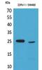 SSX Family Member 1 antibody, A07363, Boster Biological Technology, Western Blot image 