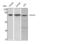 Ezrin antibody, STJ93016, St John