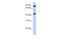 Neuronal PAS Domain Protein 2 antibody, 28-809, ProSci, Enzyme Linked Immunosorbent Assay image 