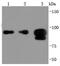 Forkhead Box P1 antibody, NBP2-66853, Novus Biologicals, Western Blot image 