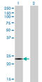 Cbp/P300 Interacting Transactivator With Glu/Asp Rich Carboxy-Terminal Domain 4 antibody, LS-C134126, Lifespan Biosciences, Western Blot image 